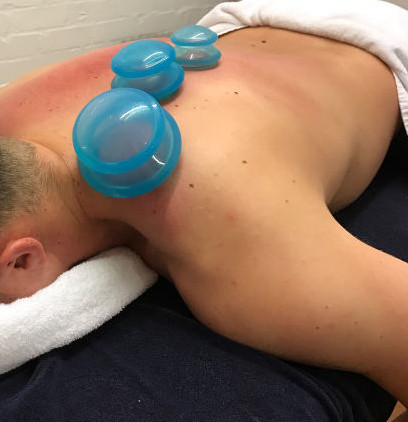 Cupping Therapy at Back On Track Chiropractic + Acupuncture by Dr. Callan Martin DC, CCSP Overland Park, KS 66210 Chiropractor